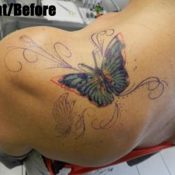 butterfly shoulder before